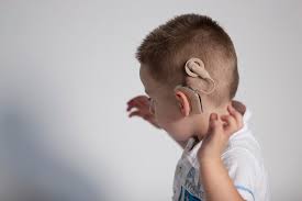 Cochlear Implant Surgery in Children